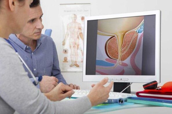 medikuak gaixoa kontsultatzen du prostatitisaren inguruan