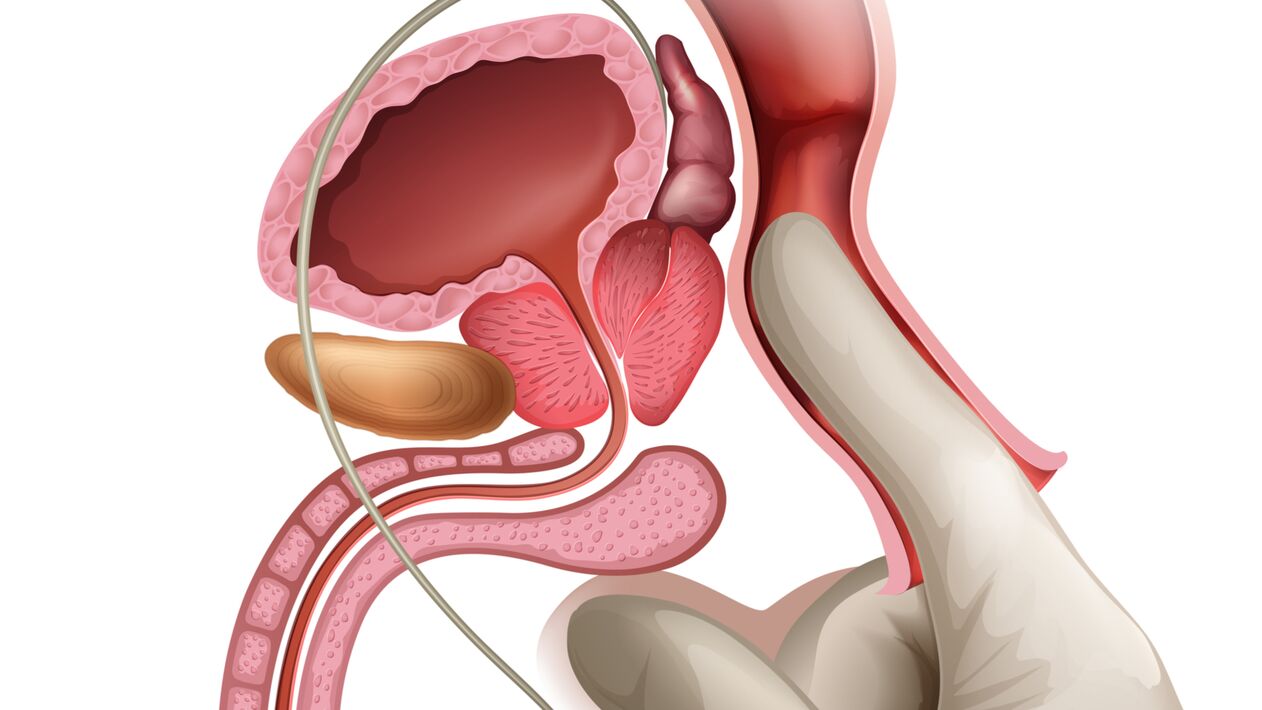 Prostatako masajea prostatitis kongestiboa tratatzeko modu eraginkorra da