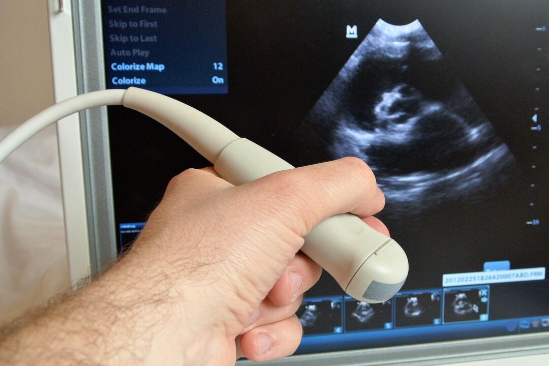 Ultrasoinuak gizon baten prostatitis kongestiboa diagnostikatzen lagunduko du